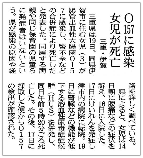 n157ɊtȂǂ̋@\ቺnAŏǏǌQigtrj𕹔SiOdEɉj